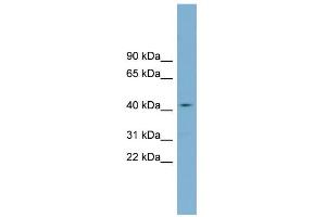 Western Blotting (WB) image for anti-Zinc Finger, DHHC-Type Containing 18 (ZDHHC18) (Middle Region) antibody (ABIN2775530)