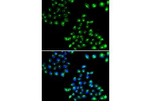 Immunofluorescence analysis of U20S cell using COPB2 antibody. (COPB2 抗体)