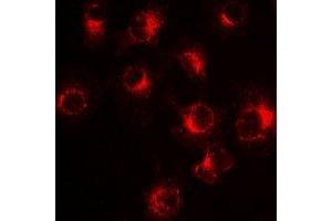 Immunofluorescent analysis of PiT2 staining in Hela cells. (SLC20A2 抗体)