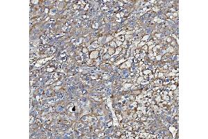 IHC analysis of Poliovirus Receptor/PVR using anti-Poliovirus Receptor/PVR antibody (ABIN7601069).