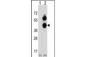 Western blot analysis of BCAT2 (arrow) using rabbit polyclonal BCAT2 Antibody (C-term) (ABIN656822 and ABIN2846033). (BCAT2 抗体  (C-Term))