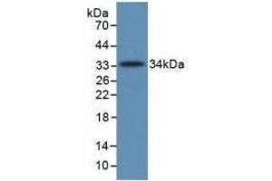 Western blot analysis of recombinant Human C5a. (C5A 抗体  (AA 678-751))
