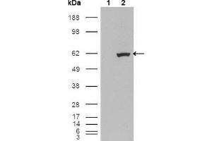 Western blot analysis using ETV1 mouse mAb against HEK293T cells transfected with the pCMV6-ENTRY control (1) and pCMV6-ENTRY ETV1 cDNA (2). (ETV1 抗体  (AA 1-191))