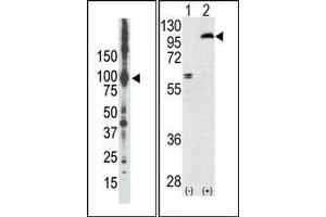 (LEFT)Western blot analysis of anti-PKCepsilon Pab in placenta lysate. (PKC epsilon 抗体  (N-Term))