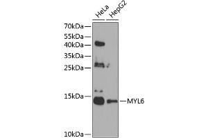 Western blot analysis of extracts of various cell lines, using MYL6 antibody (ABIN6129612, ABIN6144255, ABIN6144257 and ABIN6224653) at 1:1000 dilution.