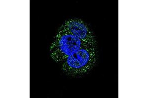 Confocal immunofluorescent analysis of AGL Antibody (Center) (ABIN1882062 and ABIN2839246) with HepG2 cell followed by Alexa Fluor 488-conjugated goat anti-rabbit lgG (green). (AGL 抗体  (AA 357-387))