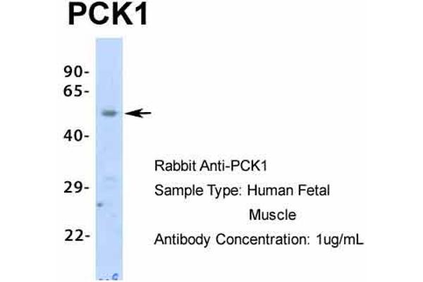 PCK1 抗体  (Middle Region)