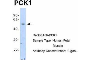 Host:  Rabbit  Target Name:  PCK1  Sample Type:  Human Fetal Muscle  Antibody Dilution:  1. (PCK1 抗体  (Middle Region))