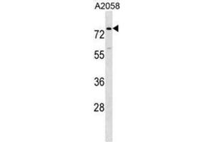 BCAS1 Antibody (N-term) western blot analysis in A2058 cell line lysates (35µg/lane). (BCAS1 抗体  (N-Term))