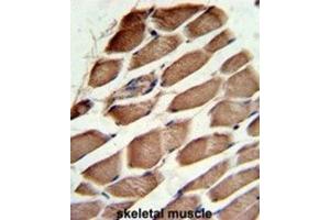Immunohistochemistry (IHC) image for anti-ARP3 Actin-Related Protein 3 (ACTR3) antibody (ABIN3001697) (ACTR3 抗体)