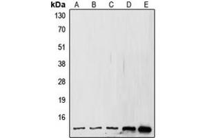 Western blot analysis of SUMO1 expression in MCF7 (A), A431 (B), HeLa (C), mouse kidney (D), rat kidney (E) whole cell lysates. (SUMO1 抗体  (N-Term))