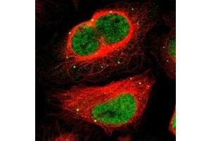 Immunofluorescent staining of U-2 OS with MEF2D polyclonal antibody  (Green) shows positivity in vesicles and nucleus but excluded from the nucleoli. (MEF2D 抗体)