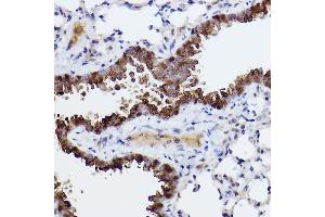 Immunohistochemistry of paraffin-embedded mouse lung using Caspase-6 Rabbit mAb (ABIN7266119) at dilution of 1:100 (40x lens). (Caspase 6 抗体)