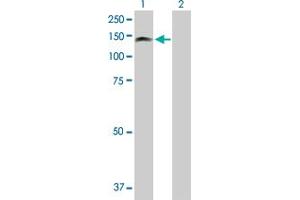Western Blot analysis of PKN3 expression in transfected 293T cell line by PKN3 MaxPab polyclonal antibody.
