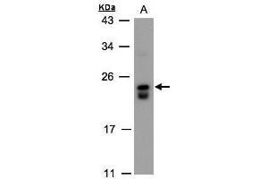 WB Image Sample(30 ug whole cell lysate) A:Raji , 12% SDS PAGE antibody diluted at 1:500 (DUSP19 抗体)