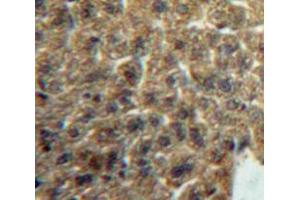 Used in DAB staining on fromalin fixed paraffin-embedded Liver tissue (Lacritin 抗体  (AA 20-138))
