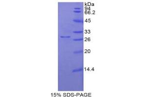 SDS-PAGE analysis of Pig NOS3 Protein. (ENOS 蛋白)
