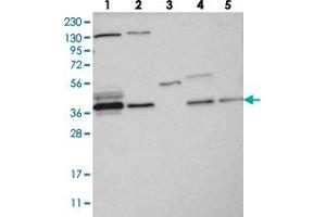 Western blot analysis of Lane 1: RT-4, Lane 2: U-251 MG, Lane 3: Human Plasma, Lane 4: Liver, Lane 5: Tonsil with VTA1 polyclonal antibody  at 1:250-1:500 dilution. (VTA1 抗体)