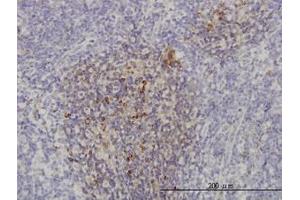 Image no. 1 for anti-Phosphoinositide-3-Kinase, Catalytic, beta Polypeptide (PIK3CB) (AA 147-257) antibody (ABIN466076) (PIK3CB 抗体  (AA 147-257))