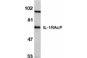 Image no. 1 for anti-Interleukin 1 Receptor Accessory Protein (IL1RAP) (C-Term) antibody (ABIN202581) (IL1RAP 抗体  (C-Term))