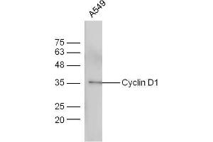 Cyclin D1 抗体  (AA 61-110)