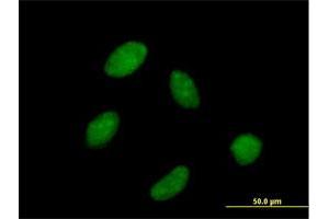 Immunofluorescence (IF) image for anti-Polymerase (RNA) III (DNA Directed) Polypeptide C (62kD) (POLR3C) (AA 1-534) antibody (ABIN524053)