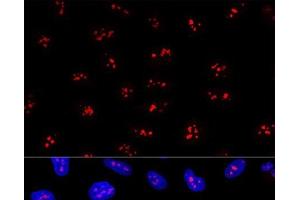 Confocal immunofluorescence analysis of U2OS cells using EBNA1BP2 Polyclonal Antibody at dilution of 1:200. (EBNA1BP2 抗体)