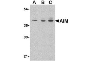 Image no. 1 for anti-CD5 Molecule-Like (CD5L) (C-Term) antibody (ABIN318735) (CD5L 抗体  (C-Term))