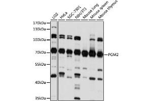 Western blot analysis of extracts of various cell lines, using PGM2 antibody (ABIN7269312) at 1:1000 dilution. (Phosphoglucomutase 2 抗体  (AA 1-130))