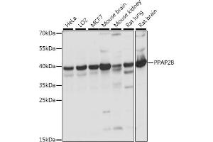Western Blotting (WB) image for anti-Phosphatidic Acid Phosphatase Type 2B (PPAP2B) (AA 1-100) antibody (ABIN7269278)