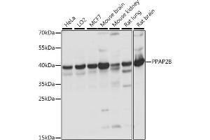 Western blot analysis of extracts of various cell lines, using PPB antibody (ABIN7269278) at 1:1000 dilution. (PPAP2B 抗体  (AA 1-100))