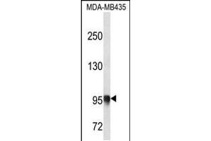 Western blot analysis in MDA-MB435 cell line lysates (35ug/lane). (PLOD3 抗体  (N-Term))