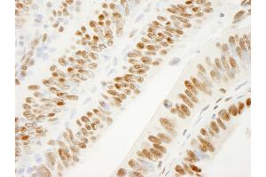 Immunohistochemistry (IHC) image for anti-KH Domain Containing, RNA Binding, Signal Transduction Associated 1 (KHDRBS1) (AA 1-50) antibody (ABIN7448786)