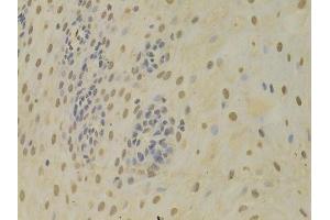 Immunohistochemistry of paraffin-embedded human esophagus using HNRNPK Antibody.