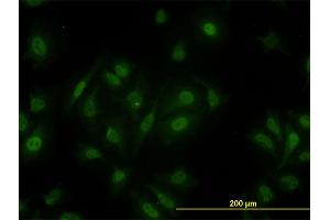 Immunofluorescence of monoclonal antibody to PCQAP on HeLa cell. (MED15 抗体  (AA 1-88))