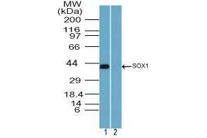 Image no. 3 for anti-SRY (Sex Determining Region Y)-Box 1 (SOX1) (AA 100-150) antibody (ABIN960348) (SOX1 抗体  (AA 100-150))