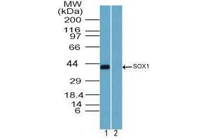 Image no. 3 for anti-SRY (Sex Determining Region Y)-Box 1 (SOX1) (AA 100-150) antibody (ABIN960348) (SOX1 抗体  (AA 100-150))