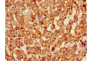 Immunohistochemistry of paraffin-embedded human liver tissue using ABIN7159651 at dilution of 1:100 (ALDH6A1 抗体  (AA 274-399))