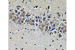 Immunohistochemistry of paraffin-embedded Mouse brain using PLCG1 Polyclonal Antibody at dilution of 1:100 (40x lens). (Phospholipase C gamma 1 抗体)