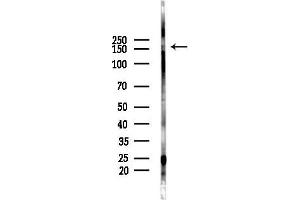 Western blot analysis of lysates from EC304 cells(heat-shock,45 min treatment), using LATS1/2 Antibody at 1/1000 dilution.