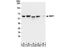 anti-N-Myristoyltransferase 1 (NMT1) (AA 68-118) antibody
