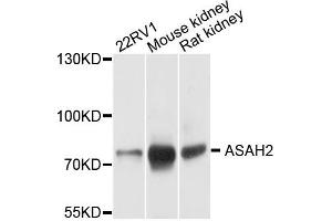 Western blot analysis of extracts of mouse testis, using ASAH2 antibody. (ASAH2 抗体)