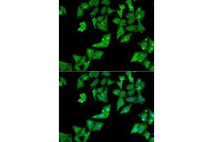 Immunofluorescence analysis of HeLa cell using AGA antibody. (AGA 抗体)