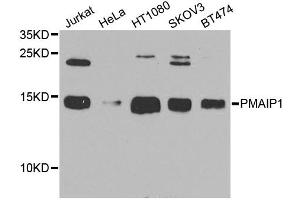 Western blot analysis of extracts of various cell lines, using PMAIP1 antibody. (NOXA 抗体)