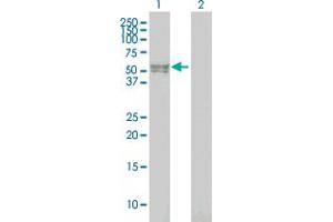 Western Blotting (WB) image for anti-Bone Morphogenetic Protein Receptor, Type IB (BMPR1B) (AA 14-103) antibody (ABIN560084)