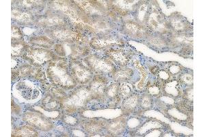 ABIN7096004 and ABIN7100066 at 1/100 staining human normal kidney tissue by IHC-P.
