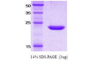 SDS-PAGE (SDS) image for Killer Cell Immunoglobulin-Like Receptor, Two Domains, Short Cytoplasmic Tail, 4 (KIR2DS4) protein (ABIN666835) (KIR2DS4 蛋白)