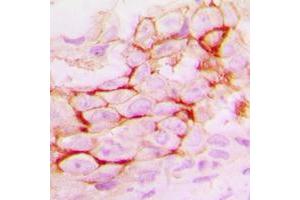 Immunohistochemistry (IHC) image for anti-Matrix Metallopeptidase 14 (Membrane-inserted) (MMP14) (C-Term) antibody (ABIN7296330)