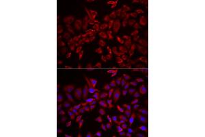 Immunofluorescence analysis of HeLa cells using CSRP3 antibody. (CSRP3 抗体)