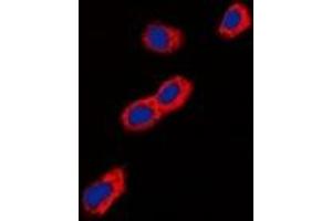 Immunofluorescent analysis of GIP Receptor staining in A549 cells. (GIPR 抗体)